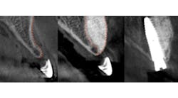 Content Dam Sr Online Articles 2017 03 17mar9pialee Thumb Content Dam Sr Online Articles 2017 03 17mar9pialee Thumb