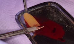 17apr13piagumdrop P02 17apr13piagumdrop P02