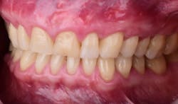 17apr13piagumdrop P21 17apr13piagumdrop P21