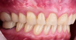 17apr13piagumdrop P22 17apr13piagumdrop P22