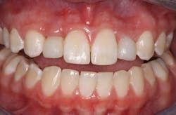 17may11piablatter P02 17may11piablatter P02