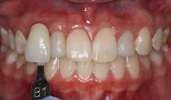 17may11piablatter P03 17may11piablatter P03