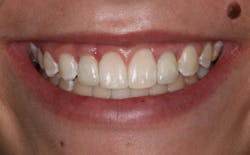 17may11piablatter P04 17may11piablatter P04