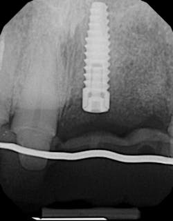 17jun8piafroum P01 17jun8piafroum P01