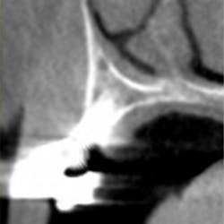 17jun8piafroum P02 17jun8piafroum P02