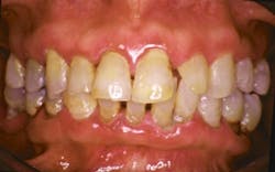 17jun8piaherndon P01 17jun8piaherndon P01