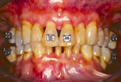 17jun8piaherndon P02 17jun8piaherndon P02