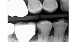 Content Dam Sr Online Articles 2017 06 17jun8piaford Thumb Content Dam Sr Online Articles 2017 06 17jun8piaford Thumb