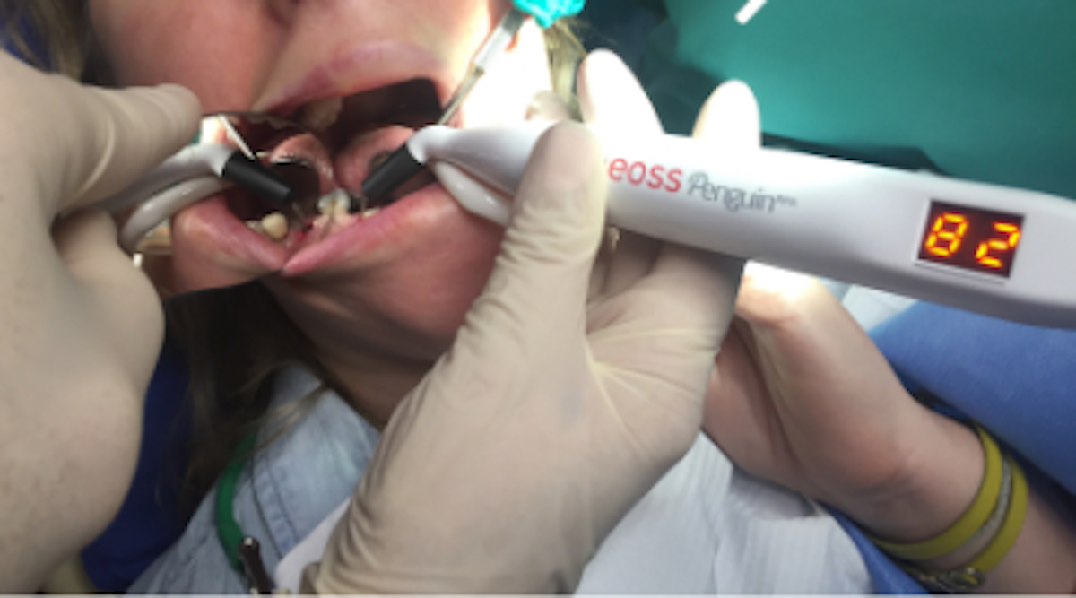 Are We There Yet A New Instrument That Determines When Dental Implants Are Ready To Be Restored Perio Implant Advisory