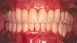 Content Dam Sr Online Articles 2017 06 17jun8piaherndon Thumb Content Dam Sr Online Articles 2017 06 17jun8piaherndon Thumb