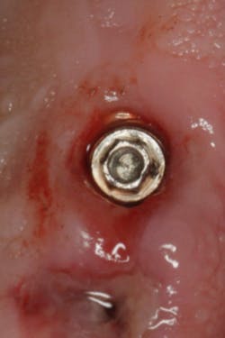 17aug10piagober Weitz P07 17aug10piagober Weitz P07