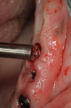 17aug10piagober Weitz P09 17aug10piagober Weitz P09