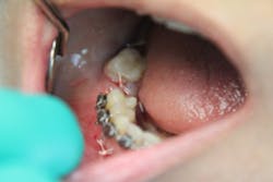 17aug10piastrange P01 17aug10piastrange P01