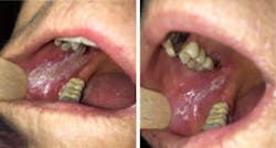 17aug10piastrange P06 17aug10piastrange P06