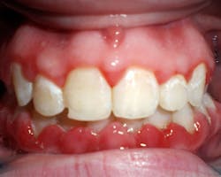 17aug10piastrange P07 17aug10piastrange P07