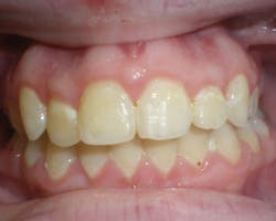 17aug10piastrange P08 17aug10piastrange P08