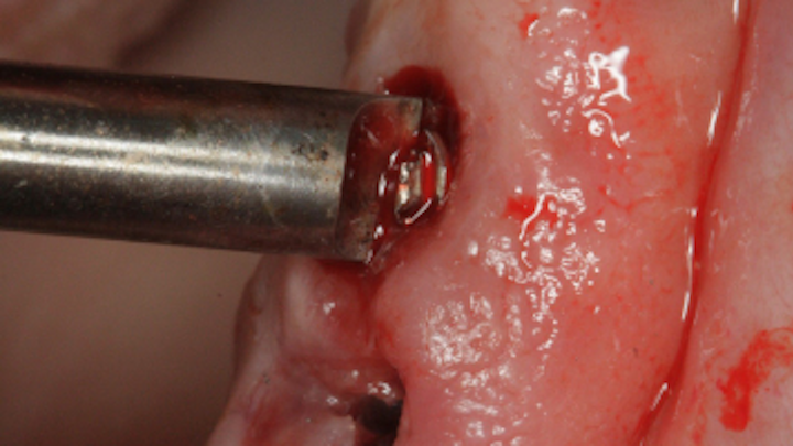 Content Dam Sr Online Articles 2017 08 17aug10piagober Weitz Thumb