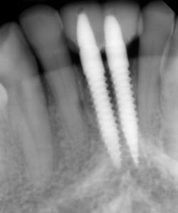 17sept14piamann P09 17sept14piamann P09