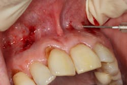 17oct12piafroum P02 17oct12piafroum P02