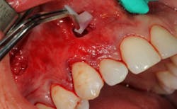 17oct12piafroum P04 17oct12piafroum P04