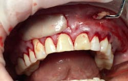 17oct12piafroum P05 17oct12piafroum P05