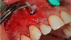 Content Dam Sr Online Articles 2017 10 17oct12piafroum Thumb Content Dam Sr Online Articles 2017 10 17oct12piafroum Thumb