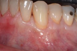 17dec14piabernottip01 17dec14piabernottip01