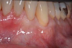 17dec14piabernottip01a 17dec14piabernottip01a