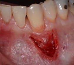 17dec14piabernottip02 17dec14piabernottip02