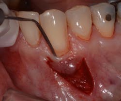 17dec14piabernottip03 17dec14piabernottip03