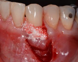 17dec14piabernottip03a 17dec14piabernottip03a