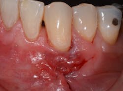 17dec14piabernottip04 17dec14piabernottip04