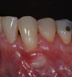 17dec14piabernottip06 17dec14piabernottip06