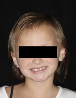 17dec14piadaxonp01 17dec14piadaxonp01