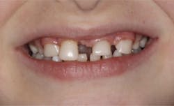 17dec14piadaxonp02 17dec14piadaxonp02