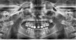 17dec14piadaxonp03 17dec14piadaxonp03