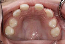 17dec14piadaxonp04a 17dec14piadaxonp04a