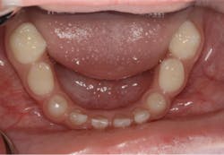 17dec14piadaxonp04b 17dec14piadaxonp04b