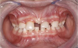 17dec14piadaxonp05 17dec14piadaxonp05