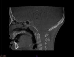 17dec14piadaxonp07 17dec14piadaxonp07