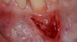 Content Dam Sr Online Articles 2017 12 17dec14piabernottit Content Dam Sr Online Articles 2017 12 17dec14piabernottit