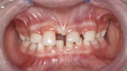 Content Dam Sr Online Articles 2017 12 17dec14piadaxont Content Dam Sr Online Articles 2017 12 17dec14piadaxont