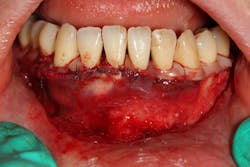 18jan11piaclintip01 18jan11piaclintip01