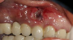 Content Dam Sr Online Articles 2018 01 18jan11piachiapascot Content Dam Sr Online Articles 2018 01 18jan11piachiapascot