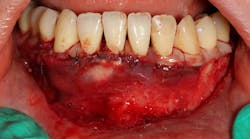 Content Dam Sr Online Articles 2018 01 18jan11piaclintipthumb Content Dam Sr Online Articles 2018 01 18jan11piaclintipthumb