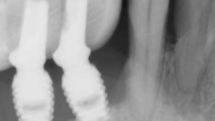 Content Dam Sr Online Articles 2018 01 18jan11piasjfroumt