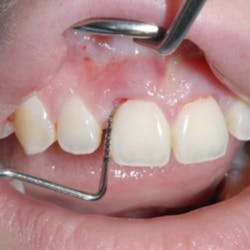 18feb8piaclintip02rev 18feb8piaclintip02rev