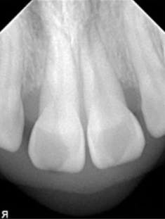 18feb8piaclintip03rev 18feb8piaclintip03rev