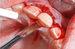 18feb8piaclintip04rev 18feb8piaclintip04rev