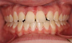 18feb8piaclintip06rev 18feb8piaclintip06rev